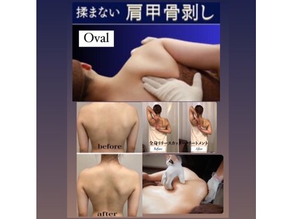 オーヴァル(Oval)の写真