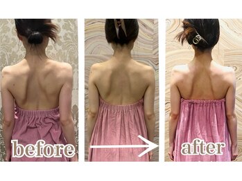 ロココ 表参道店(Rococo)/姿勢改善に特化しております！