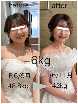 ハッチー(Hacchi)/【20代】ブライダル痩身！