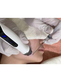 小顔になりたい