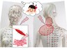 【首の痛み・左右の傾き】過去に痛めた、肩～後頭部の筋肉の硬直が原因かも？