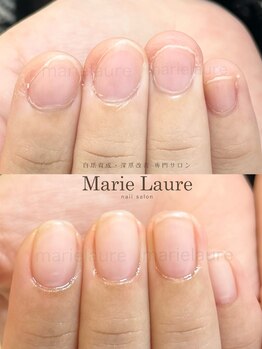 マリーロール 天王寺店(Marie Laure)/深爪矯正/自爪育成/ネイルケア