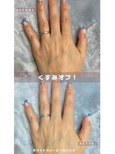 ブロッサム(Blossom)/ホワイトスノーピールハンドケア