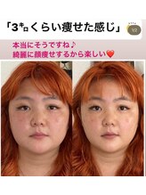 あいはな/「３キロくらい痩せた感じ」