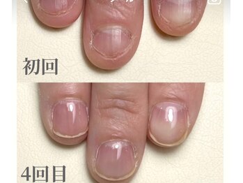 ラピシア(Rapicia)/