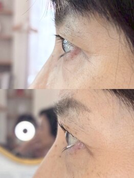 ダーム ド ローズ(Dame de rose)/【まぶたが上がるまつ毛パーマ】