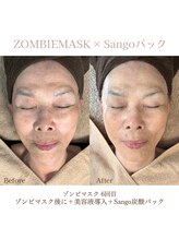 アルッカ(Arukka)/ゾンビ×Sango炭酸パック