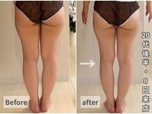 ヒールプラス(heal+)の雰囲気（痩身効果をその場で体感したい方へおすすめです◎）