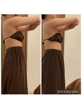 リス(LYS)/[大阪江坂/ブライダル]45分×3回