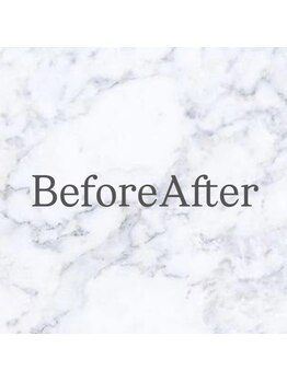 デマントイド(Demantoide&Co)/BeforeAfter