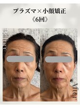 ネイルアンドアンチエイジングドゥシール(Docile)/60代女性｜たるみ・しわ改善