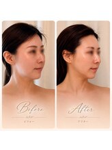 アミュ ル ブラン ナゴヤ(AMU Le blanc NAGOYA)/【症例写真】