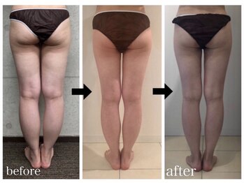 ワイサロン(Y salon)/バストを残してダイエット/美脚