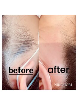 ニコホリ(NIKOHORI)/イベント前に身だしなみケア！！