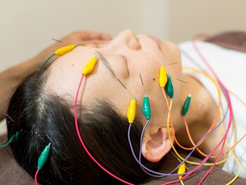 おいかわ整骨院の写真/【美容鍼でリフトアップ♪】お顔だけでない体のケアで内臓の働きを整えていき、肌悩みの根本改善・小顔へ！