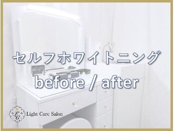 ライトケアサロン 銀座店(Light Care Salon)/セルフホワイトニングの症例写真