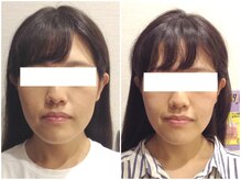 美容整体ウェリナ 名駅院/小顔矯正/骨盤矯正/美脚サロン 