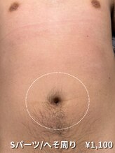 カナウ(KANAU)/【Sパーツ/脱毛】へそ周り