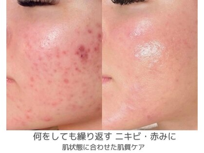 ラクシュミー(laksmi)の写真