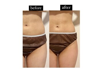 マルレ 三軒茶屋(MARLE)/腰回りのもたつきに