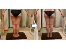 サロンドタエ(salon de TAE)/ウルトラ下半身集中