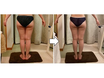 サロンドタエ(salon de TAE)/ウルトラ下半身集中