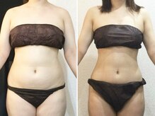 ウェリナ平和堂長久手院/小顔矯正/骨盤矯正/痩身/整体