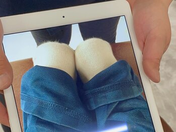 J'Sメディカル整体院 赤坂院/10.骨盤を整えて足長差の改善！