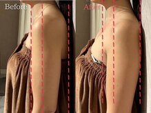 ミューズファクトリー(Muse factory)/二の腕ほっそり！姿勢矯正も◎