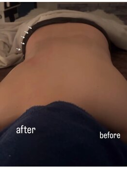 オーシャンブルーム 目黒(OceanBloom)/左右1回の変化ハイパーナイフ