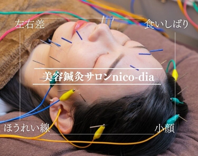 気になるほうれい線に！刺さない美容鍼♥600本　肩こりや足のむくみにも！ ダーマローラー 美容器 フェイスローラー 刺さない美容鍼 美肌