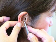 ばば鍼灸院の雰囲気（貼ってるのを忘れるほど、違和感なく耳のツボを刺激します）