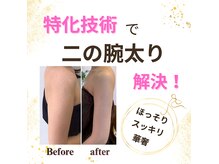 ミント(Mint)の雰囲気（スッキリ二の腕で自信をもってノースリーブを！）
