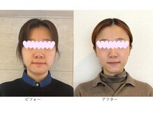 ベルメイク(BELLE MAKE)/美整コルギ☆ビフォーアフター