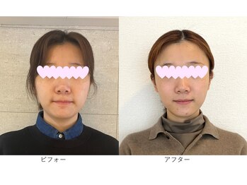 ベルメイク(BELLE MAKE)/美整コルギ☆ビフォーアフター