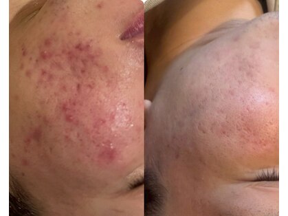 スローティラテ 中道店の写真