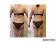 エステサロン ラ マーノ(La mano)/美Body実現！3ケ月で6キロ減★