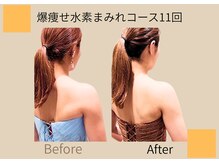 ヨサパーク ココロ 町田店(YOSA PARK COCORO)/Beforeafter