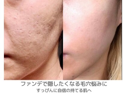 ラクシュミー(laksmi)の写真