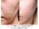 ラクシュミー(laksmi)の写真