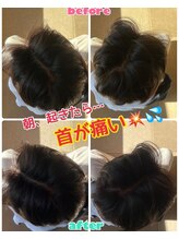 ルミネ(Lumine)/寝違いで首が痛い！首が回らない