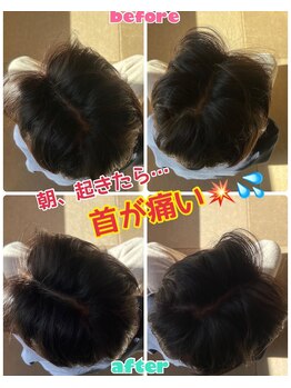 ルミネ(Lumine)/寝違いで首が痛い！首が回らない