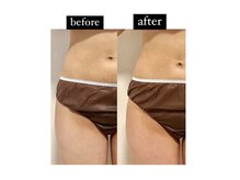 マルレ 三軒茶屋(MARLE)/くびれ