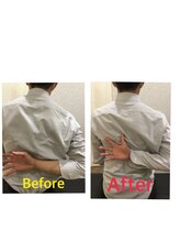 くすの樹接骨院 整体院 町田院/整体/骨盤矯正ビフォーアフター