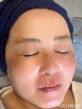 ニコホリ(NIKOHORI)/ピカピカ艶々の素肌美人に♪