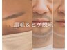 【男性限定】美眉ワックス脱毛★ヒゲ全体脱毛セット！！！　¥6500