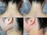 【うなじワックス脱毛】まとめ髪をする季節、首を長く魅せ洗礼された後ろ姿へ