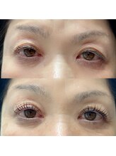 ミヌエット(MINUET)/ラッシュアディクト