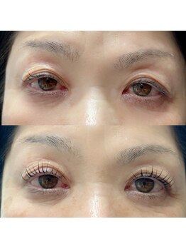 ミヌエット(MINUET)/ラッシュアディクト