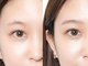 アオ(Ao)の写真/話題沸騰◆眉のお悩み一気に解決！【ハリウッドブロウリフト】あなたに似合う眉をご提案♪
